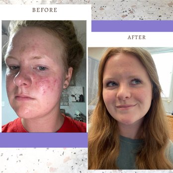 Tranquil Times - Skin Care Near Me - Charlotte, North Carolina Tranquil Times - Skin Care Near Me - Charlotte, North Carolina