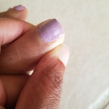Perfect3 Nail&Spa - Cuticle around my toenails not cut properly... You guys had THE NERVE to charge $20.00 for this?? - Nail Salons Near Me - Franklin Square, New York Perfect3 Nail&Spa - Cuticle around my toenails not cut properly... You guys had THE NERVE to charge $20.00 for this?? - Nail Salons Near Me - Franklin Square, New York