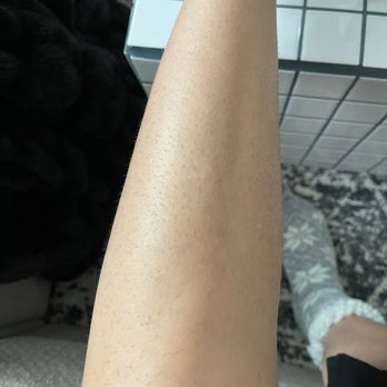 LaserAway - BEFORE my first appointment with laser away.  DATE October 2022 - Tattoo Removal Near Me - Murray, Utah