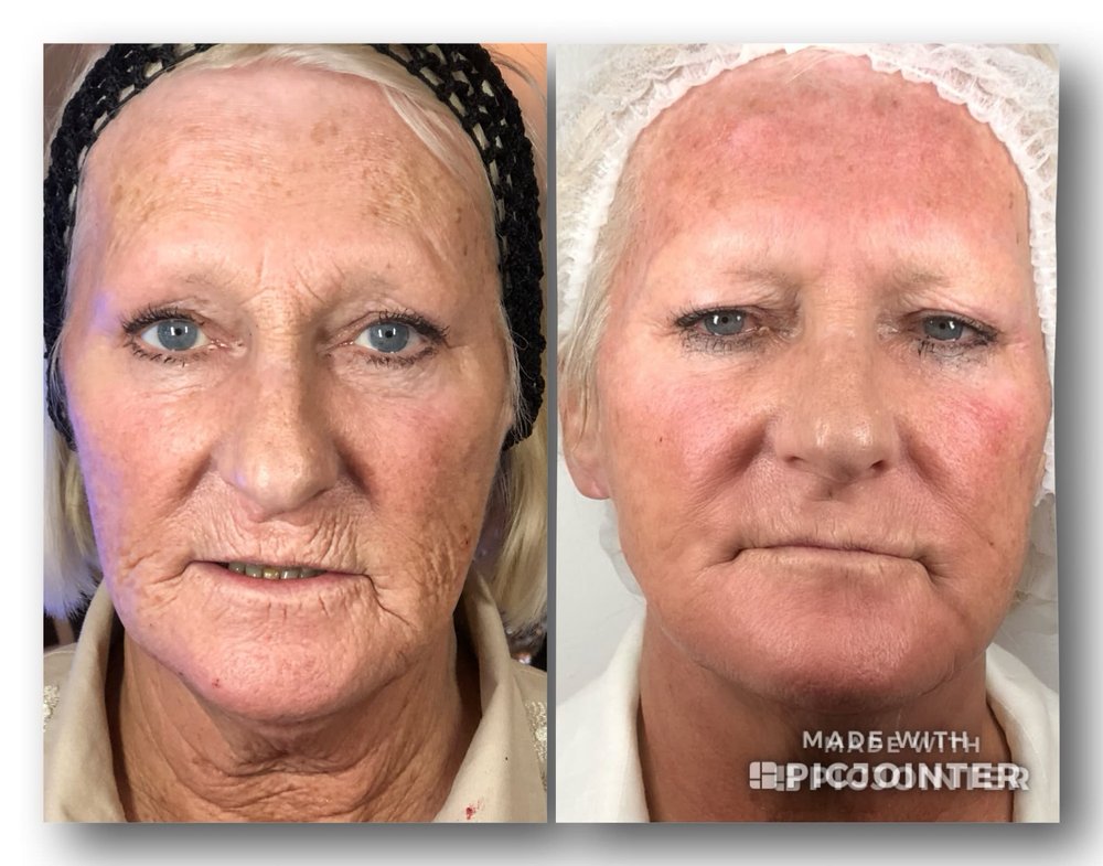THE SKIN REPAIR CLINIC Updated August 2024 16 Photos 14 Harpenden