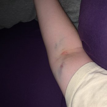 Biolife Plasma Services 12 Photos 39 Reviews Blood Plasma Donation Centers 3455 Quail Creek Dr Denton Tx Phone Number