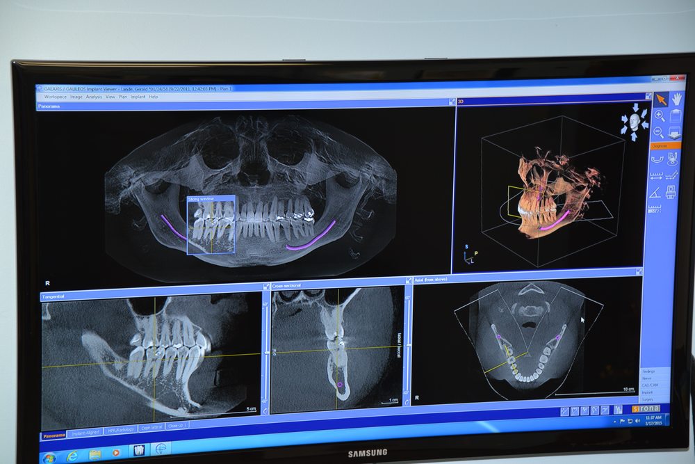 GERALD M LANDE, DDS 11 Photos General Dentistry 9699 N Michigan