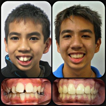 Jain Orthodontics - Orthodontists Near Me - Saddle Brook, New Jersey Jain Orthodontics - Orthodontists Near Me - Saddle Brook, New Jersey