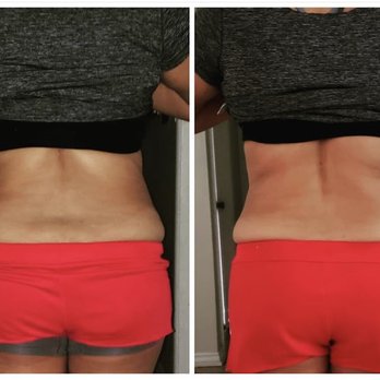 Anjelic Touch - Non Invasive treatment - Massage Therapy Near Me - Riverside, California