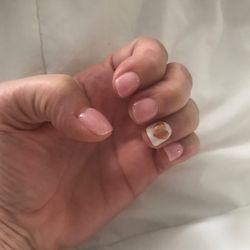 Miracle Nails