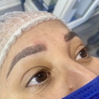 Esthetics 911 - Skin Care Near Me - Torrance, California