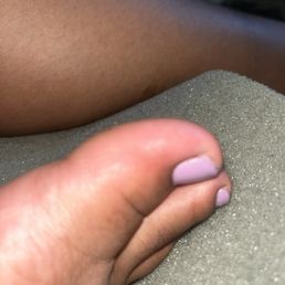 My toe is infected/inflamed after getting a pedicure here the day after. My toe is infected/inflamed after getting a pedicure here the day after.