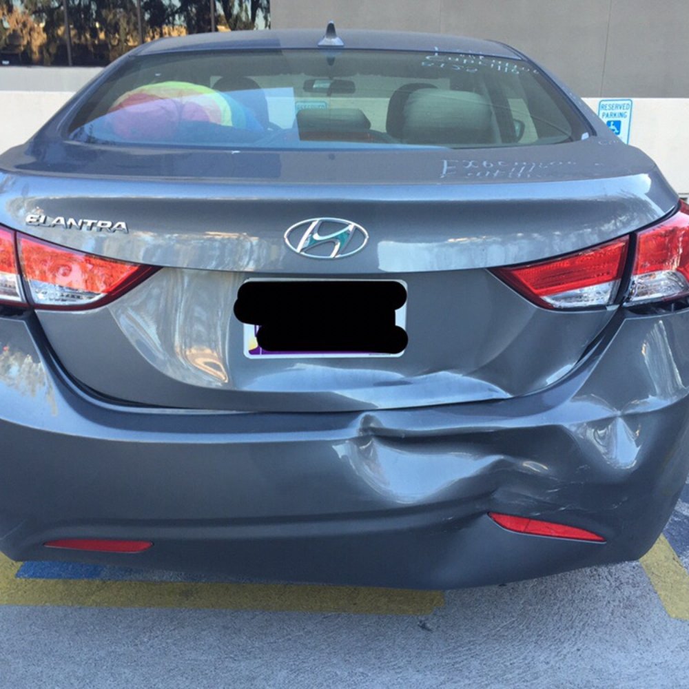 Progressive Auto Collision - 2013 Hyundai Elantra 1 of 3 - Body Shops Near Me - Glendale, Arizona