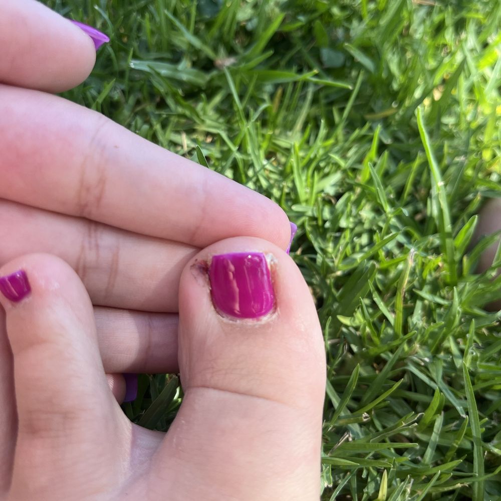 It has been one week why does a gel pedicure look like this... It has been one week why does a gel pedicure look like this...