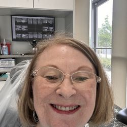 Creekview Dental Care - Myself at Creekview Dental. Placement of front crowns.