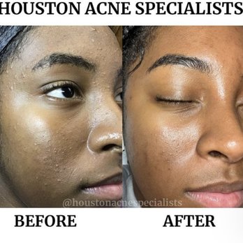 HOUSTON ACNE SPECIALISTS - Updated October 2025 - 74 Photos