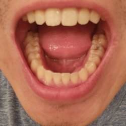 Szymanowski Orthodontics - After