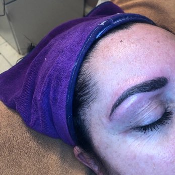 Skin Station - Brooklyn - after: love it! - Day Spas Near Me - Brooklyn, New York Skin Station - Brooklyn - after: love it! - Day Spas Near Me - Brooklyn, New York