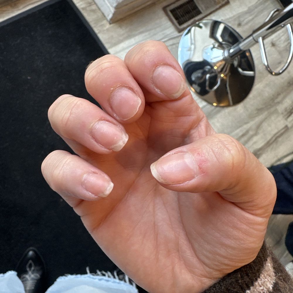 Other hand.... Nail ended up breaking. Again, 3 days later Other hand.... Nail ended up breaking. Again, 3 days later