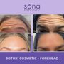Sona MedSpa