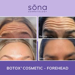 Sona MedSpa