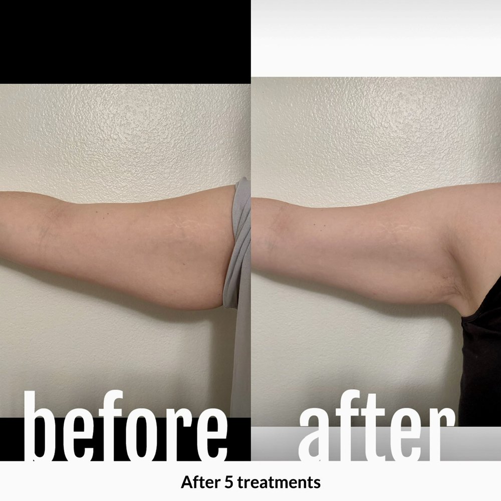 BEAUTY AND BODY WORKS 18 Photos 6400 Owensmouth Ave, Woodland Hills