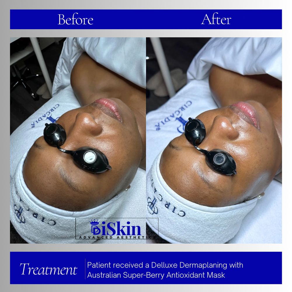 iSkin Advanced Aesthetics Logo