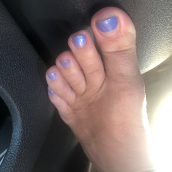 Eros Nails & Spa - This is one foot a day after my 60.00 spa pedicure.. - Nail Salons Near Me - Milford, Massachusetts Eros Nails & Spa - This is one foot a day after my 60.00 spa pedicure.. - Nail Salons Near Me - Milford, Massachusetts
