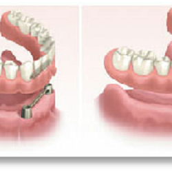Congressional Dental Care - Dentures Rockville, MD