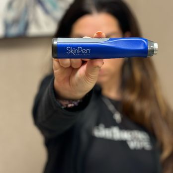 Valley Medspa - skinPen microneedling little downtime but big results. Helps with lines, texture and acne scars. - Medical Spas Near Me - Allentown, Pennsylvania Valley Medspa - skinPen microneedling little downtime but big results. Helps with lines, texture and acne scars. - Medical Spas Near Me - Allentown, Pennsylvania