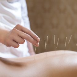 Sundhari Holistic Spa - Acupuncture treatments available.