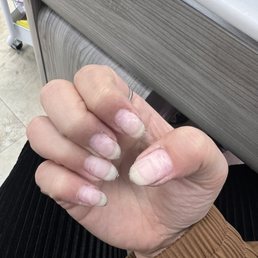 Growth after gel X and gel builder fill