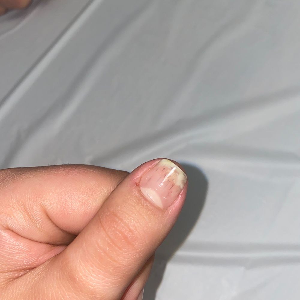 Middletown Chocolate Spa & Nails - update: got the nails taken off at another salon found the fun surprise of fungus on 5 of my nails. DONT GO HERE - Nail Salons Near Me - Middletown, New York Middletown Chocolate Spa & Nails - update: got the nails taken off at another salon found the fun surprise of fungus on 5 of my nails. DONT GO HERE - Nail Salons Near Me - Middletown, New York