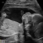 Photo of Greggory DeVore Fetal Diagnostic Center