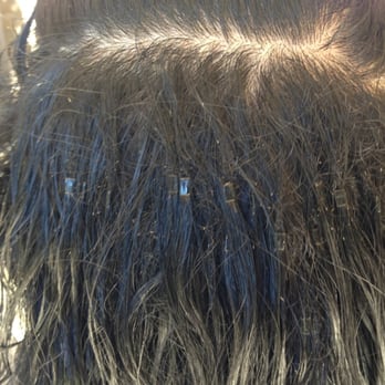 Head Lice Infestation Nits With Real Hair Extensions Yelp