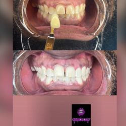Gemology Teeth Whitening Service