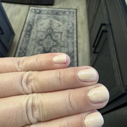 My poor pinky cut, only made worse by her filing on that spot.