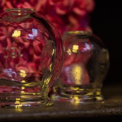 Cupping...this ancient technique does wonders for pain.