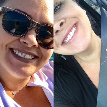 Susan Millar, DDS - Cosmetic Dentists Near Me - Costa Mesa, California