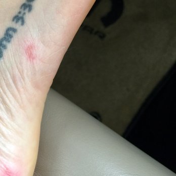 In Style Nails - Feet now wrapped in triple antibiotic ointment and bandages. - Nail Salons Near Me - Lone Tree, Colorado In Style Nails - Feet now wrapped in triple antibiotic ointment and bandages. - Nail Salons Near Me - Lone Tree, Colorado
