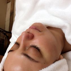 Beautiful skin starts with a facial, after microdermabrasion & pumpkin Enzyme .