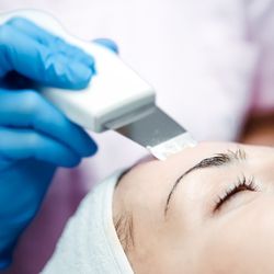 Novoskin - Ultrasonic peel
