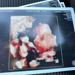 Mommy and Me 3D 4D Ultrasound - Our ultrasound specialist took her time to make sure we got to see our boy
