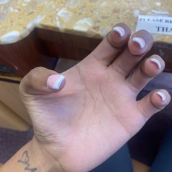 Look at how thick & beat up these nails look fresh out the chair smh.