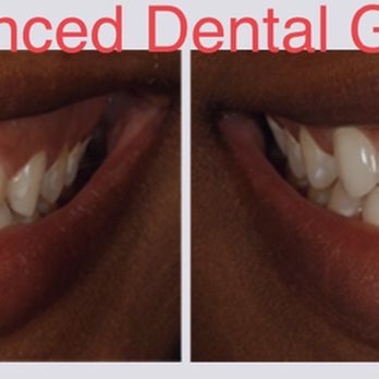 Advanced Dental Group & Orthodontics - Cosmetic Dentist - General Dentistry Near Me - Whittier, California Advanced Dental Group & Orthodontics - Cosmetic Dentist - General Dentistry Near Me - Whittier, California