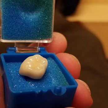 ACE Dental - they do offer lower priced materials, but if you choose the more costly gold  alloy, they are thankfully reasonable and accomodating - General Dentistry Near Me - Westminster, California