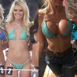 Pre op 2018 to 1 month post op 2019 Pre op 2018 to 1 month post op 2019