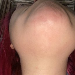After 4 sessions After 4 sessions