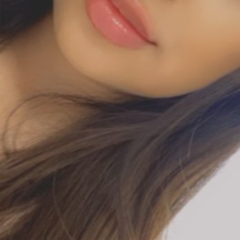 Flawless Skin Center - 2nd visit (7Months after my 1st visit) with Ani-Burbank - Laser Hair Removal Near Me - Burbank, California Flawless Skin Center - 2nd visit (7Months after my 1st visit) with Ani-Burbank - Laser Hair Removal Near Me - Burbank, California