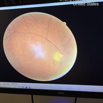 Eye Exam Associates - Picture of the retina - Optometrists Near Me - Cherry Hill, New Jersey Eye Exam Associates - Picture of the retina - Optometrists Near Me - Cherry Hill, New Jersey