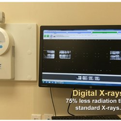 Park Dental - Xrays