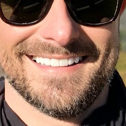 my new smile! my new smile!