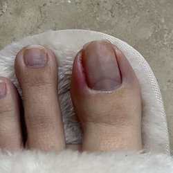 Foxy Nails & Spa - She cut me up pretty bad. Next day I had puss oozing out. The healing took 3 weeks. This photo was taken day 3 after my visit.