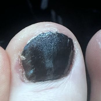 Holly and Hudson - This is the terrible job they did on my nails . This looks like a child did this - Nail Salons Near Me - Irvine, California Holly and Hudson - This is the terrible job they did on my nails . This looks like a child did this - Nail Salons Near Me - Irvine, California