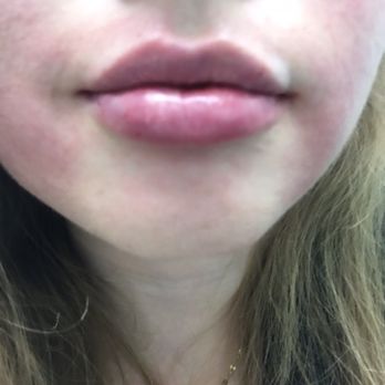 Usha Rajagopal, MD - Cosmetic Surgeons Near Me - San Francisco, California Usha Rajagopal, MD - Cosmetic Surgeons Near Me - San Francisco, California